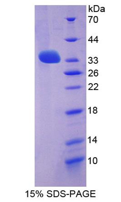 Human Recombinant Leucine Rich Repeat LGI Family, Member 3 (LGI3)