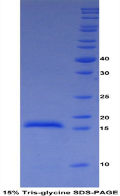 Cattle Recombinant A Disintegrin And Metalloproteinase With Thrombospondin 2 (ADAMTS2)