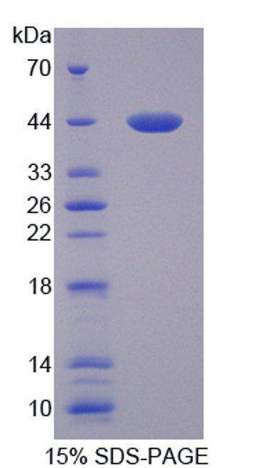 Human Recombinant A Disintegrin And Metalloproteinase With Thrombospondin 10 (ADAMTS10)