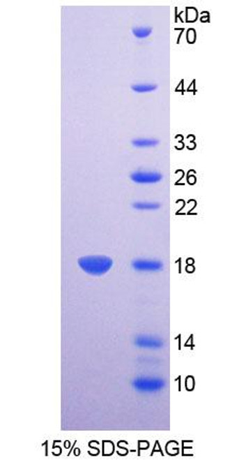 Mouse Recombinant Succinate Dehydrogenase Complex Subunit D (SDHD)