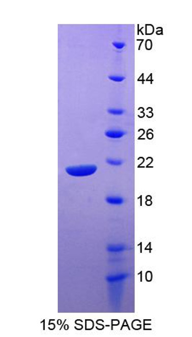 Human Recombinant Signaling Lymphocytic Activation Molecule Family, Member 7 (SLAMF7)