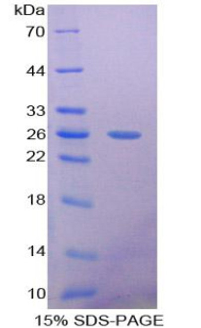 Rat Recombinant Pentraxin 3, Long (PTX3)