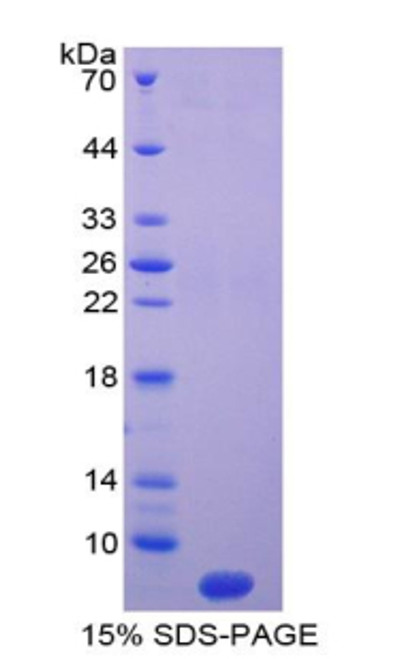 Rat Recombinant T-Kininogen 1 (KNT1)