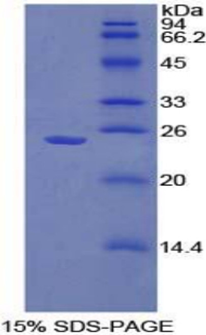 Mouse Recombinant Sprouty Homolog 1 (SPRY1)