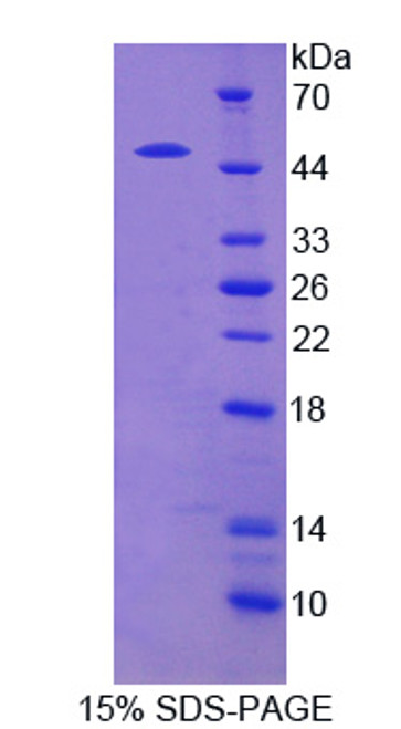 Human Recombinant Sprouty Related, EVH1 Domain Containing Protein 2 (SPRED2)