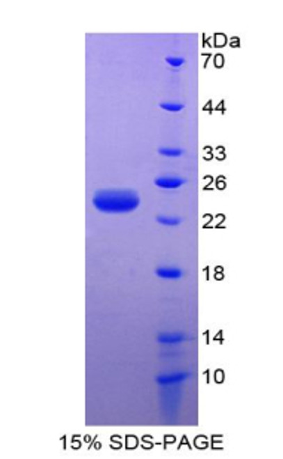 Mouse Recombinant Parkinson Disease Protein 7 (PARK7)
