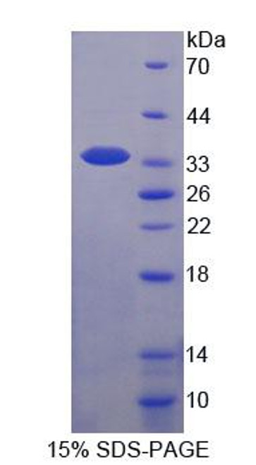 Human Recombinant WW Domain Containing E3 Ubiquitin Protein Ligase 2 (WWP2)