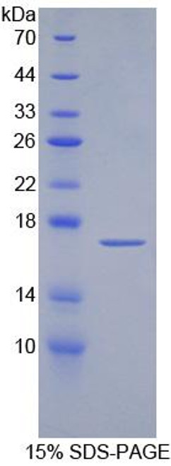 Human Recombinant Alpha-2-Glycoprotein 1, Zinc Binding (aZGP1)