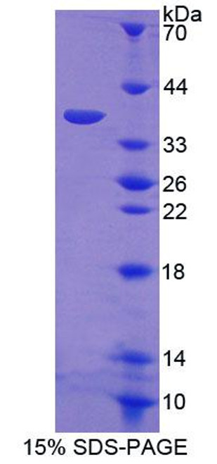 Human Recombinant Endoplasmic Reticulum Lipid Raft Associated Protein 2 (ERLIN2)