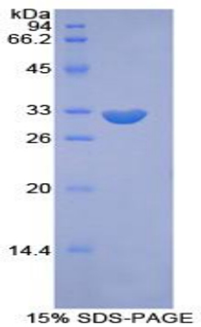 Mouse Recombinant Phosphoinositide Kinase, FYVE Finger Containing (PIKFYVE)