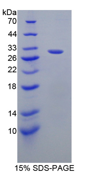 Mouse Recombinant GRB2 Associated Binding Protein 2 (GAB2)