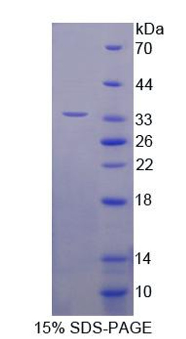 Mouse Recombinant Hermansky Pudlak Syndrome Protein 1 (HPS1)