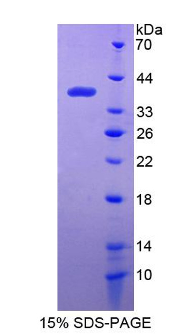 Human Recombinant Interferon Inducible Protein 35 (IFI35)