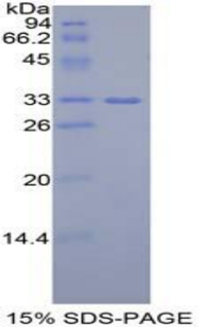 Mouse Recombinant Insulin Like Growth Factor 2 mRNA Binding Protein 2 (IGF2BP2)