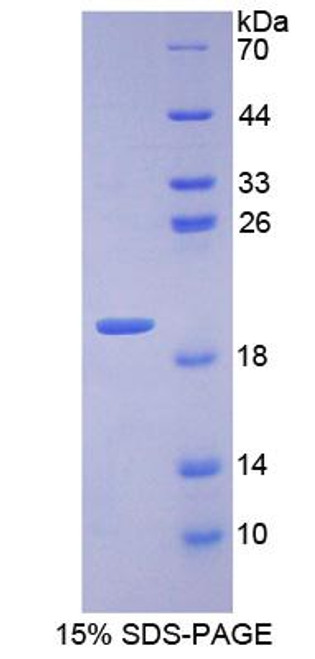 Mouse Recombinant Inositol Polyphosphate-4-Phosphatase Type I 107kDa (INPP4A)