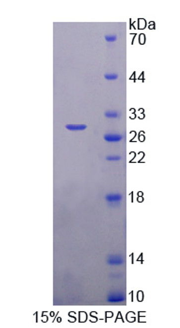 Mouse Recombinant Beta-1,3-N-Acetylglucosaminyltransferase Manic Fringe (MFNG)