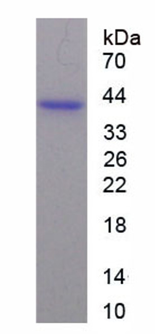 Human Recombinant Otubain 1 (OTUB1)