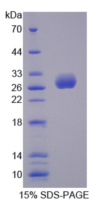 Human Recombinant UL16 Binding Brotein 2 (ULBP2)