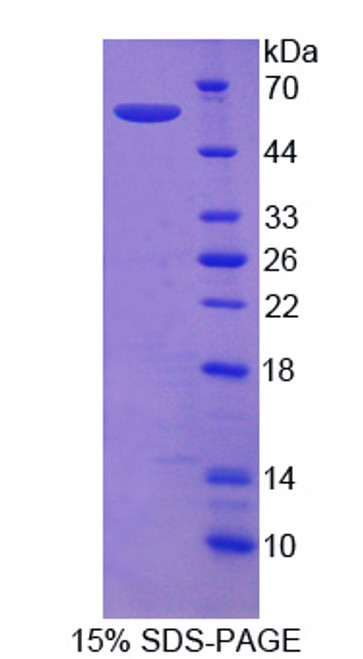 Human Recombinant Semaphorin 3E (SEMA3E)