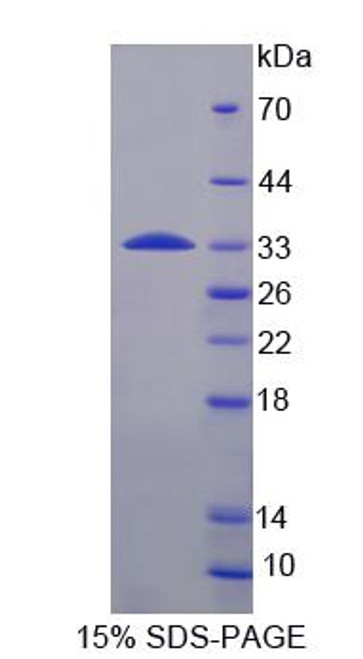 Human Recombinant Ribosomal Protein S6 Kinase Beta 1 (RPS6Kb1)