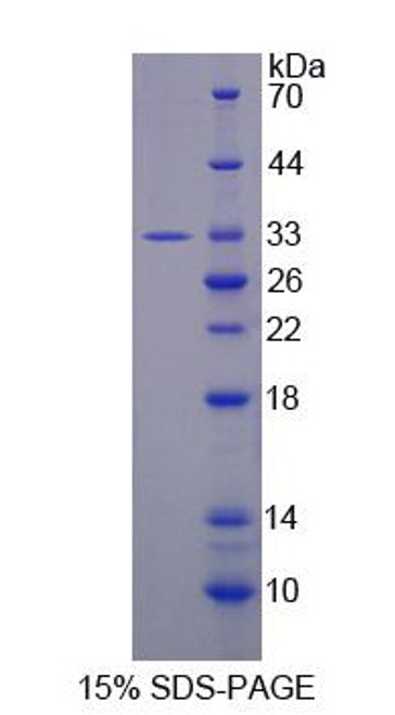 Rat Recombinant Period Circadian Protein 2 (PER2)