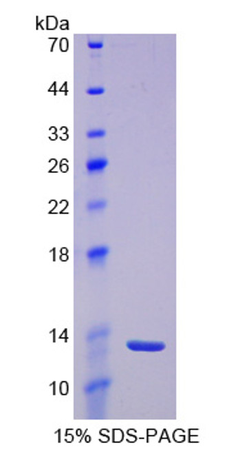 Rat Recombinant Prolactin Induced Protein (PIP)