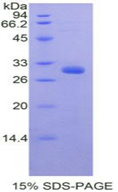 Mouse Recombinant PR Domain Containing Protein 1 (PRDM1)