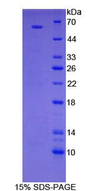 Human Recombinant Ribosomal Protein S6 Kinase Beta 2 (RPS6Kb2)