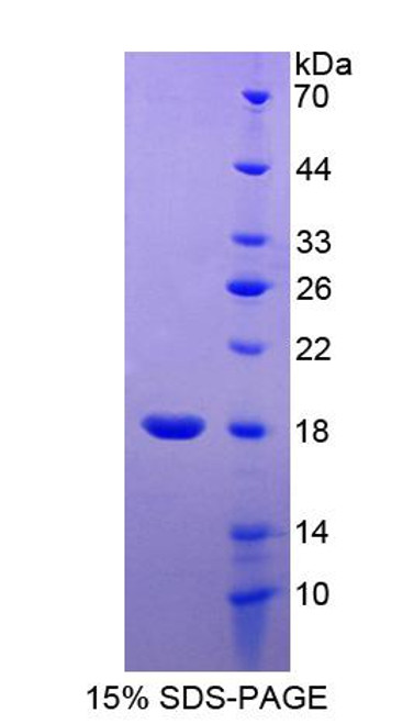 Human Recombinant RCC1 And BTB Domain Containing Protein 2 (RCBTB2)