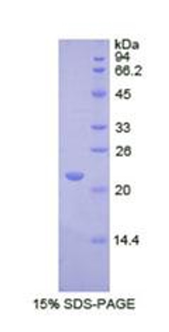 Human Recombinant RNA Exonuclease 2 Homolog (REXO2)