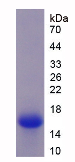 Mouse Recombinant R-Spondin 1 (RSPO1)