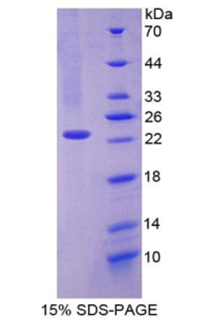 Human Recombinant CD27 Binding Protein (CD27BP)