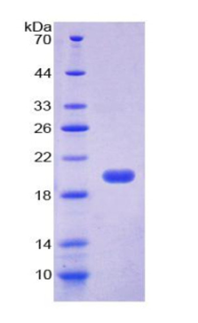 Human Recombinant Suppressor Of Ty 6 Homolog (SUPT6H)