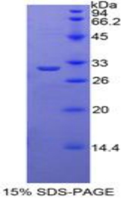 Mouse Recombinant TNFRSF1A Associated Via Death Domain Protein (TRADD)