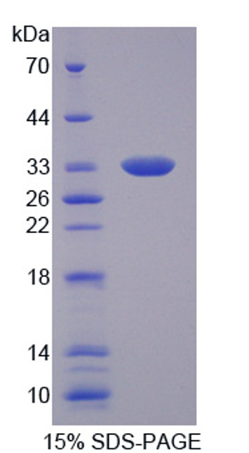 Mouse Recombinant Tumor Necrosis Factor Alpha Induced Protein 6 (TNFaIP6)