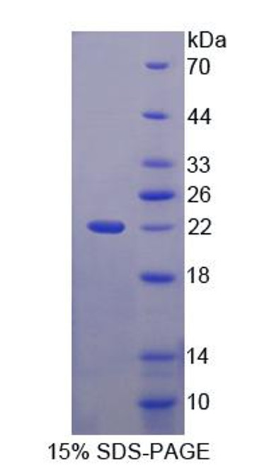 Human Recombinant Canopy 2 Homolog (CNPY2)