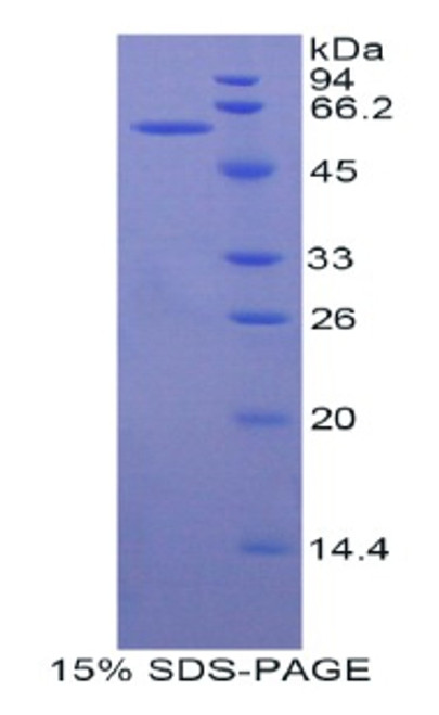 Human Recombinant Metastasis Associated In Colon Cancer 1 (MACC1)