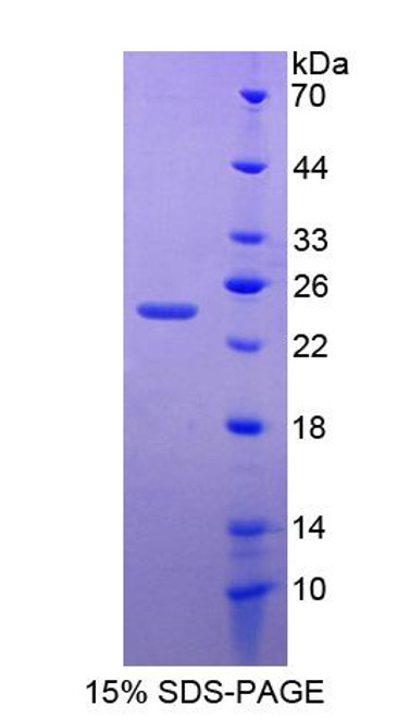 Human Recombinant Zinc Finger Homeobox Protein 4 (ZFHX4)