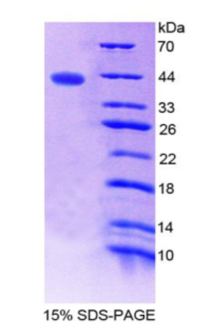 Human Recombinant Normal Mucosa Of Esophagus Specific 1 (NMES1)