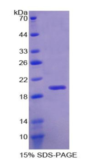 Human Recombinant RNA Binding Motif Protein 20 (RBM20)