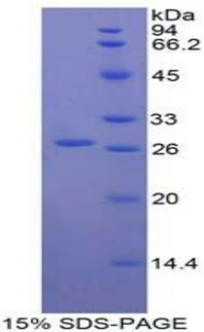 Human Recombinant T-Cell Immunoreceptor With Ig And ITIM Domains Protein (TIGIT)