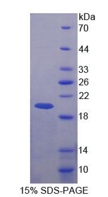 Human Recombinant BRCA1/BRCA2 Containing Complex Subunit 3 (BRCC3)