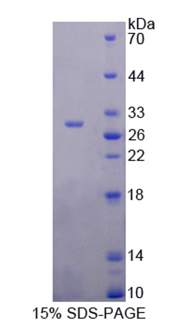 Rat Recombinant Angiopoietin Like Protein 6 (ANGPTL6)