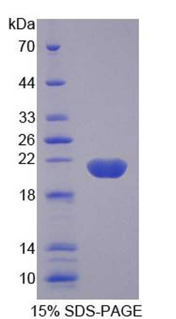 Human Recombinant Gremlin 2 (GREM2)