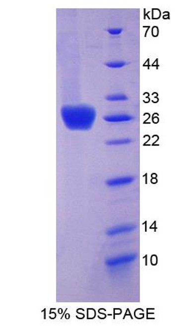 Mouse Recombinant Thrombospondin Type I Domain Containing Protein 7A (THSD7A)