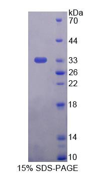 Human Recombinant Autophagy Related Protein 16 Like Protein 1 (ATG16L1)