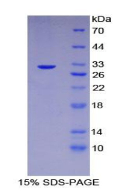 Human Recombinant Checkpoint Homolog 2 (CHEK2)