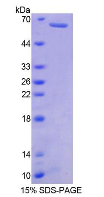 Human Recombinant Myosin Heavy Chain 7B, Cardiac Muscle Beta (MYH7B)