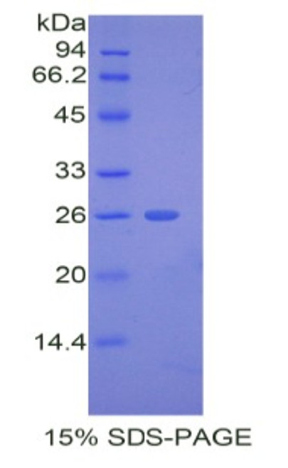 Mouse Recombinant A Disintegrin And Metalloproteinase With Thrombospondin 12 (ADAMTS12)