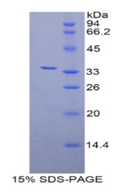 Human Recombinant Zeta Chain Associated Protein Kinase 70kDa (zAP70)